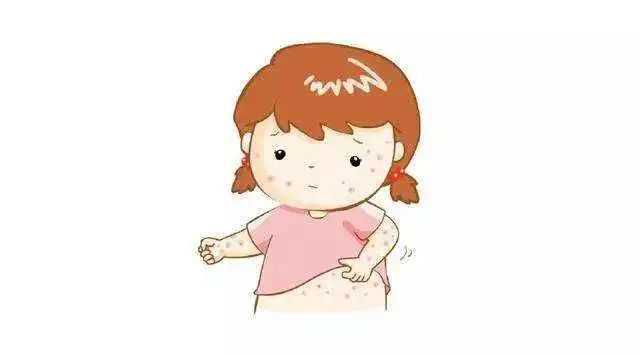 宝爸宝妈快收藏！5个祛痱小妙招来了