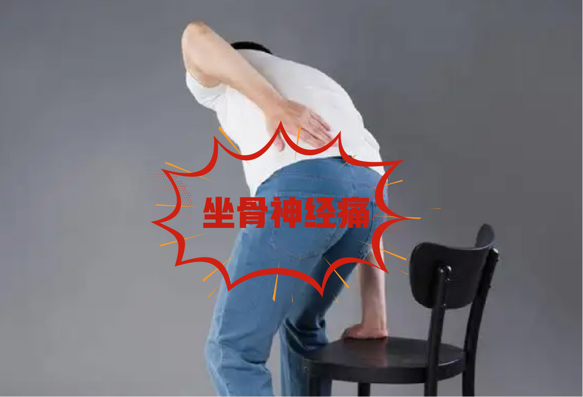 分享一张治坐骨神经痛的方子，专治灼痛，麻木，快收藏