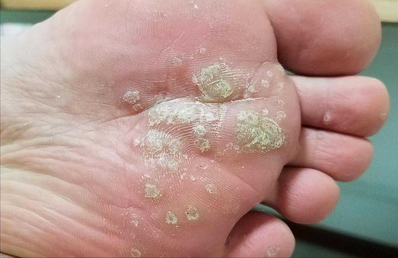 涨知识了，原来孩子流鼻血，这样就可以快速止血！有需要的快收藏